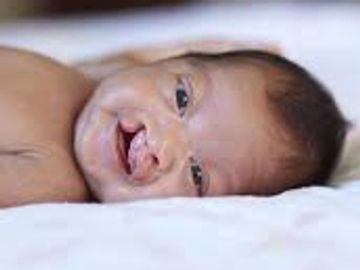 cleft lip surgery