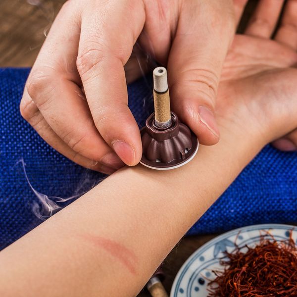 Chinese traditional medicine moxibustion