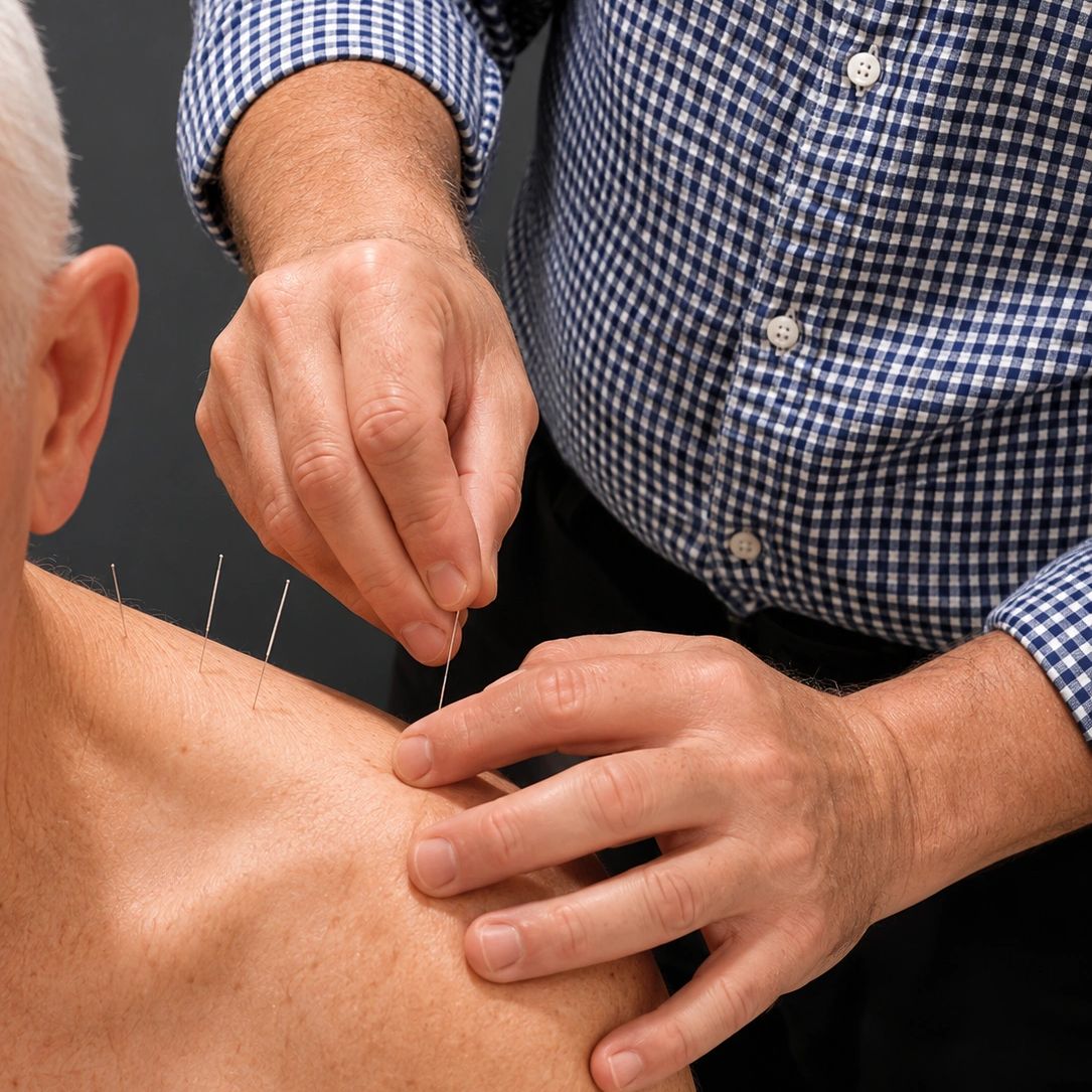 Acupuncture therapy on an elderly man's shoulder.