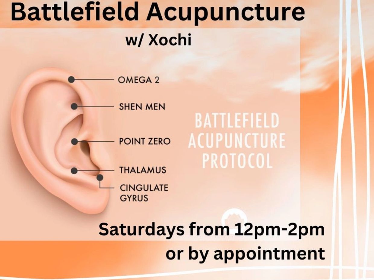 Battlefield Acupuncture Sanford Yoga & Community Center