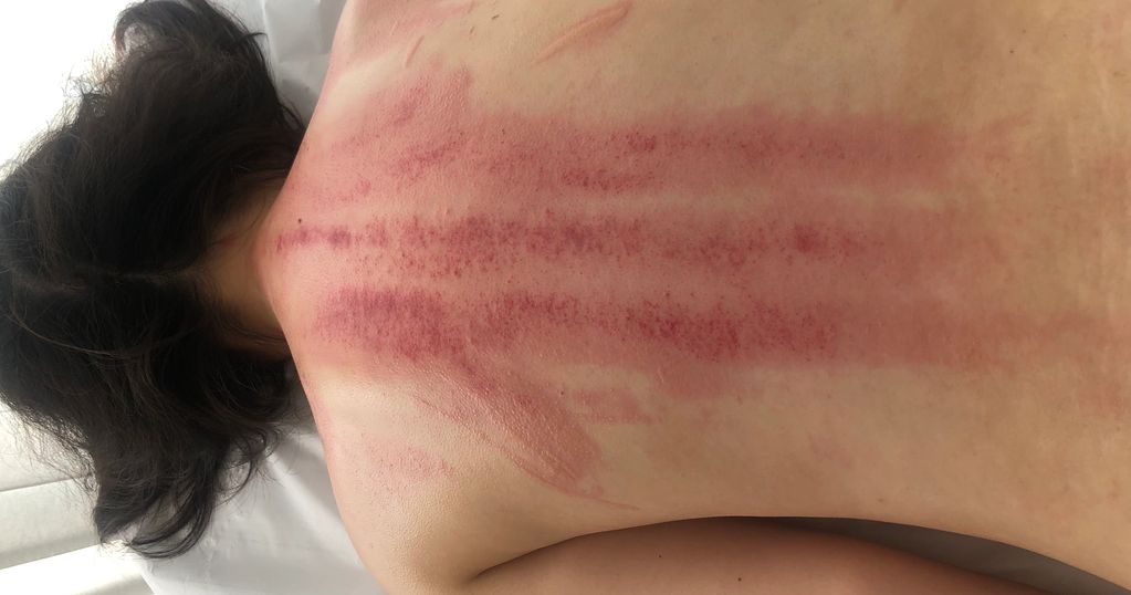 Scrapping for sensitive skin 