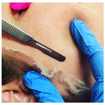 Dermaplaning technique