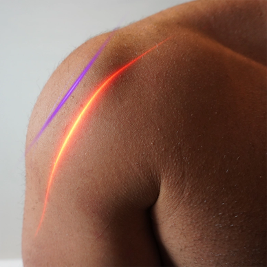 Close-up of a shoulder with glowing red and purple light streaks.