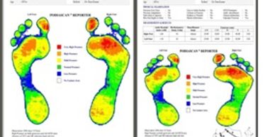 Foot innovation for insoles, inserts, and plantar fasciitis 