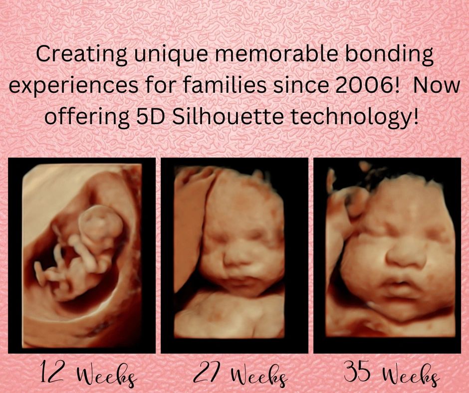 20 weeks pregnant 3d ultrasound