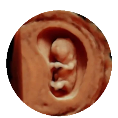 3D ultrasound image of a human fetus.