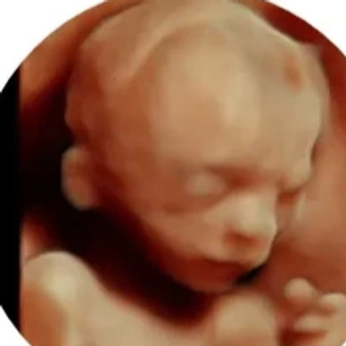 3D ultrasound scan of a fetus.
