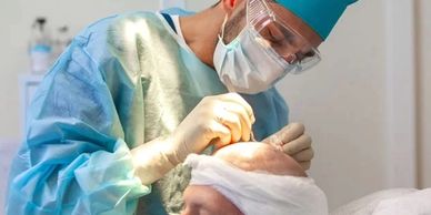 Stages Of Hair Transplantation Operation
