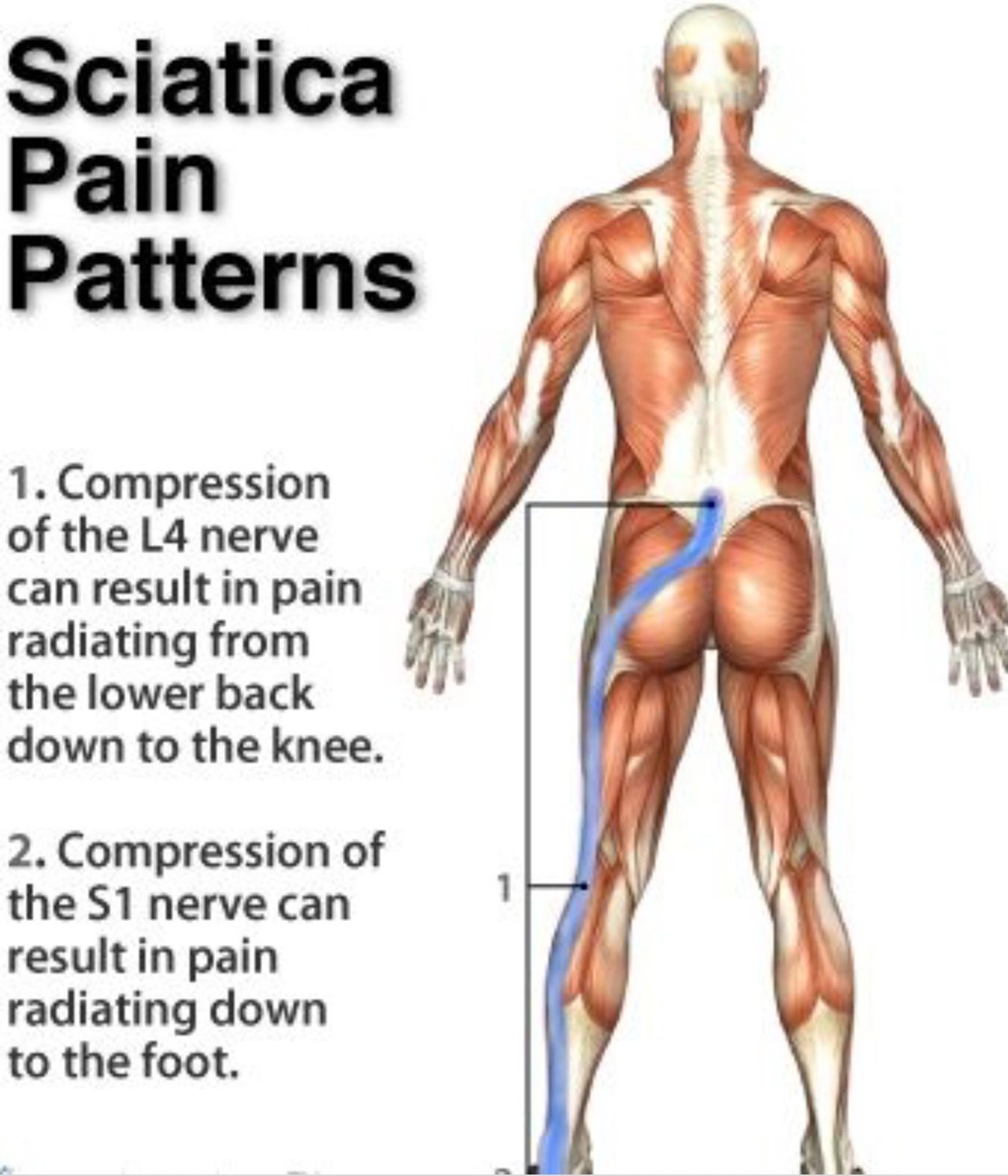 Sciatic Pain in the Gluts (rear): Relieve Pain With This Massage Technique  