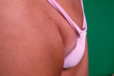 How to decrease penis size