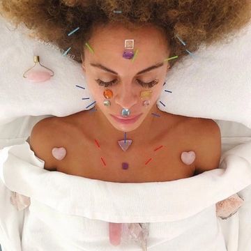 cosmetic acupunctue