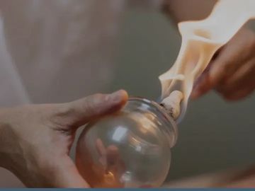 cupping