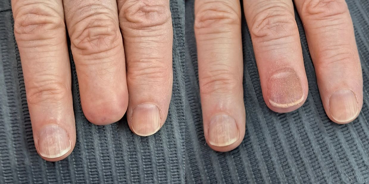 Fingernail Tattoo