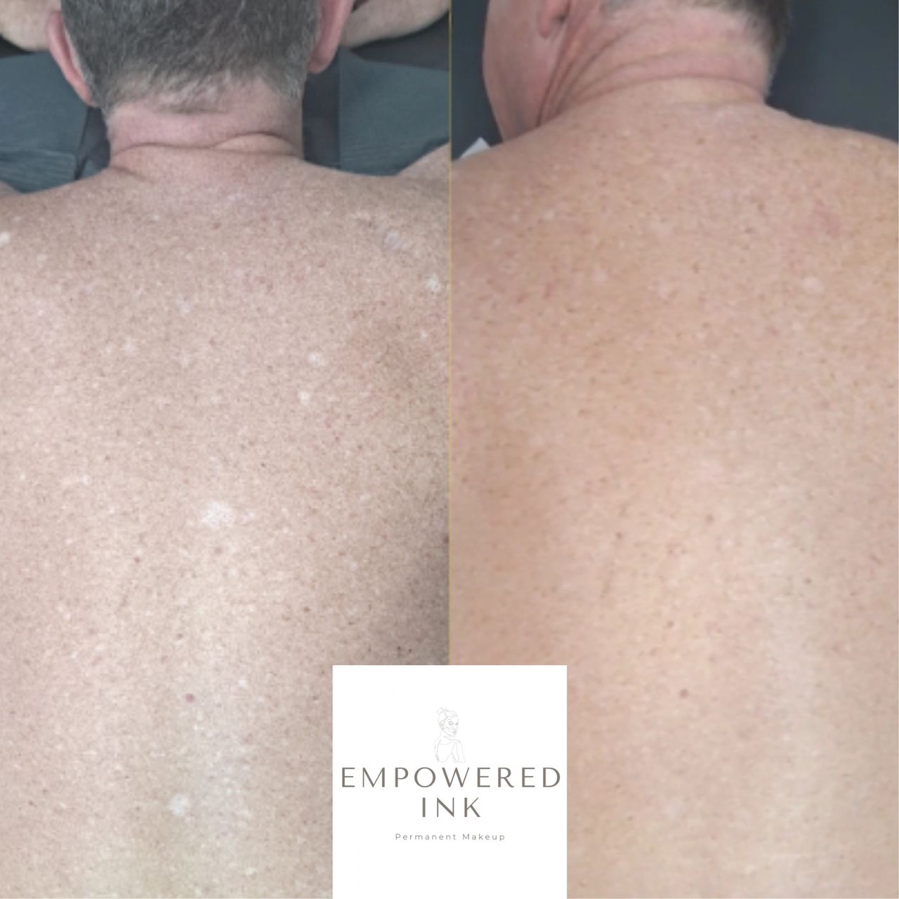 Body Peels – Chebo Clinic, image size:1280x1280