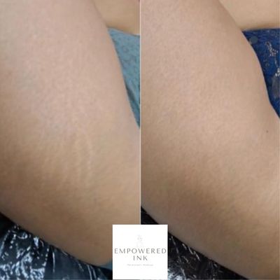 Inkless Stretch Mark Camouflage 