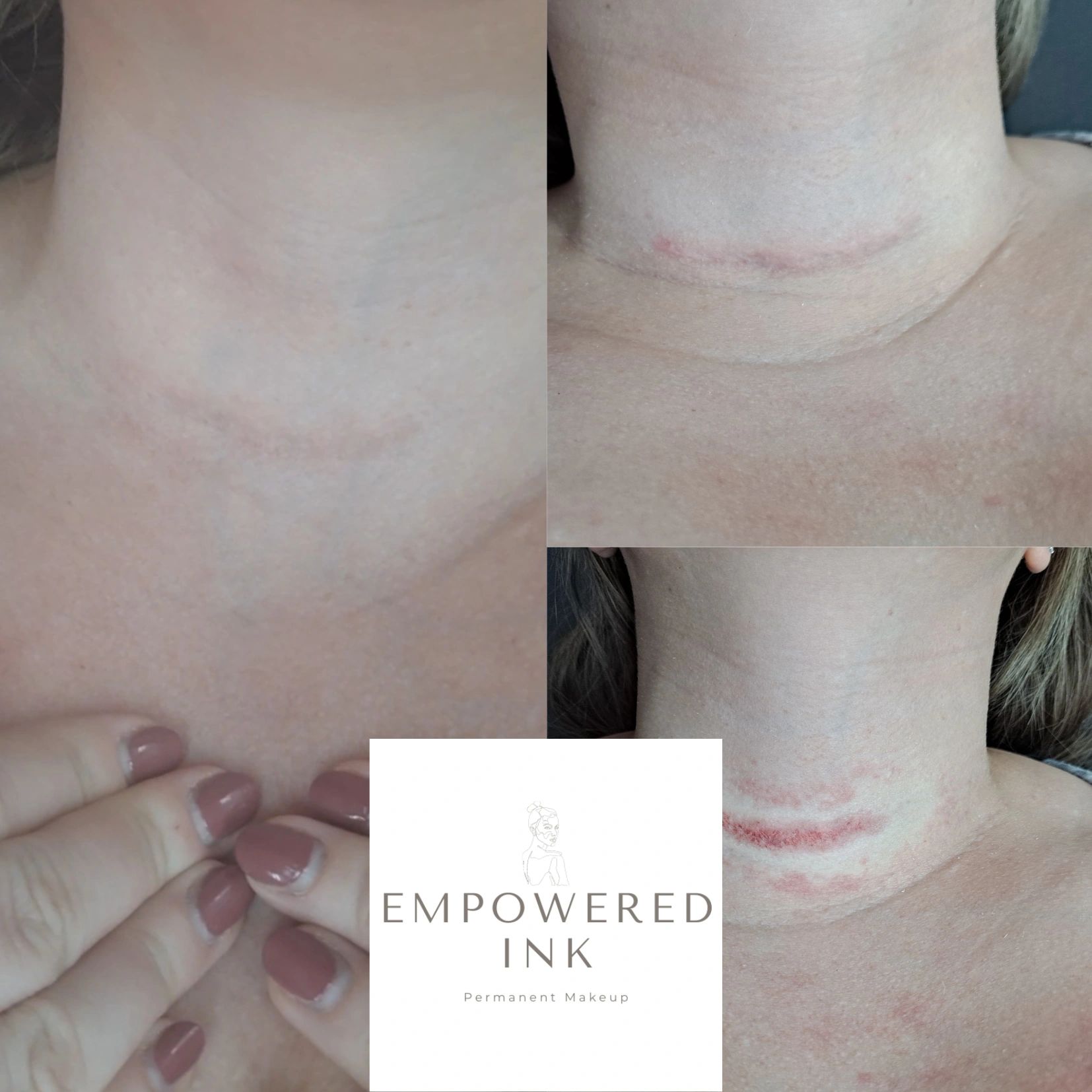 body scar coverage makeup