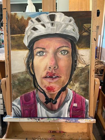 Realistic portrait of a woman cyclist with a scraped nose and chin.