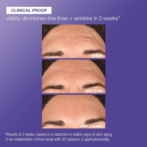 Forehead wrinkles visibly diminish after 2 weeks of product use.