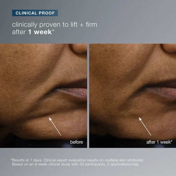 Before and after photos showing skin improvement after one week.