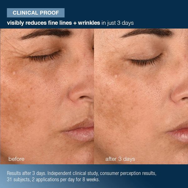Before and after skincare results showing reduced fine lines and wrinkles.