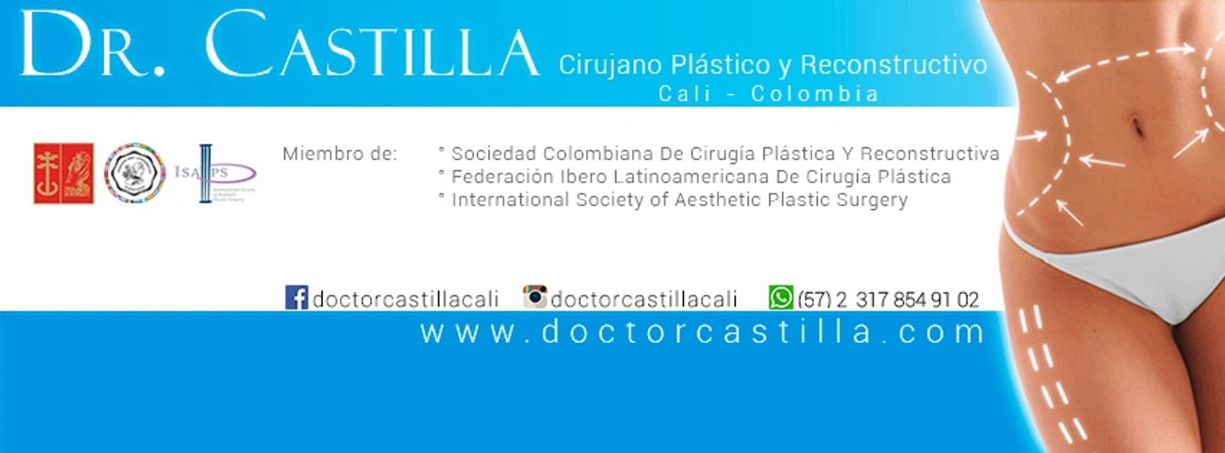 dr.castilla cirujano plástico cali colombia
retiro de biopolimeros
biopolimeros, reconstrucción de los glúteos.
