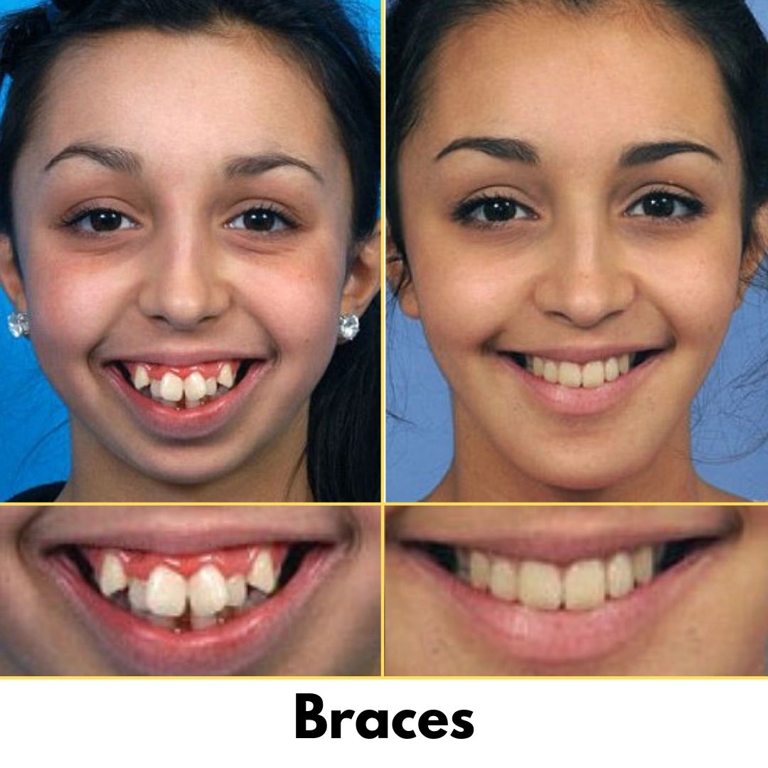 Orthodontics