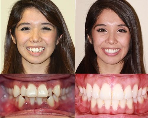 Dentist in Los Angeles Says Straight Teeth Mean Better Health