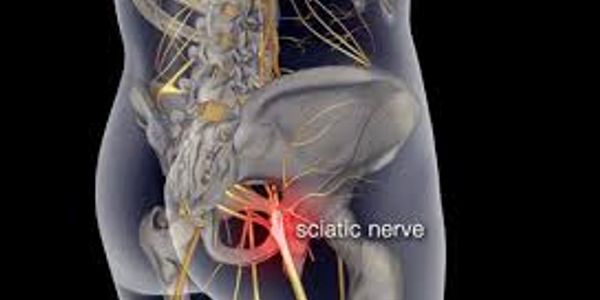 This represent sciatic nerve from the gluteals referred pain to the lower back and legs.