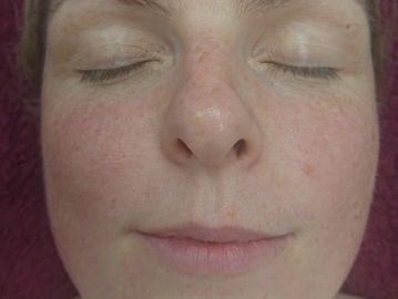 Natural Facelift Massage