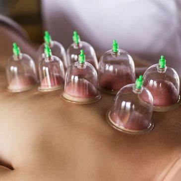 Glass cups placed on skin for cupping therapy treatment.