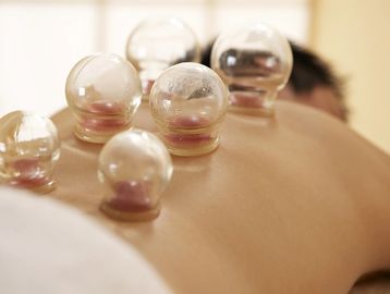 Cupping Therapy 