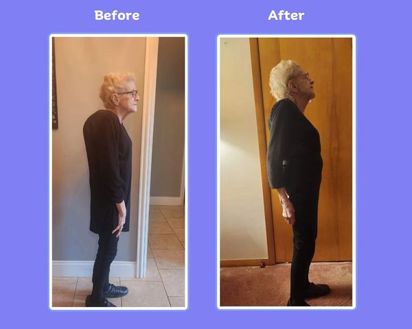 Spinal Flow Before and After photos showing Spinal Flow Results 