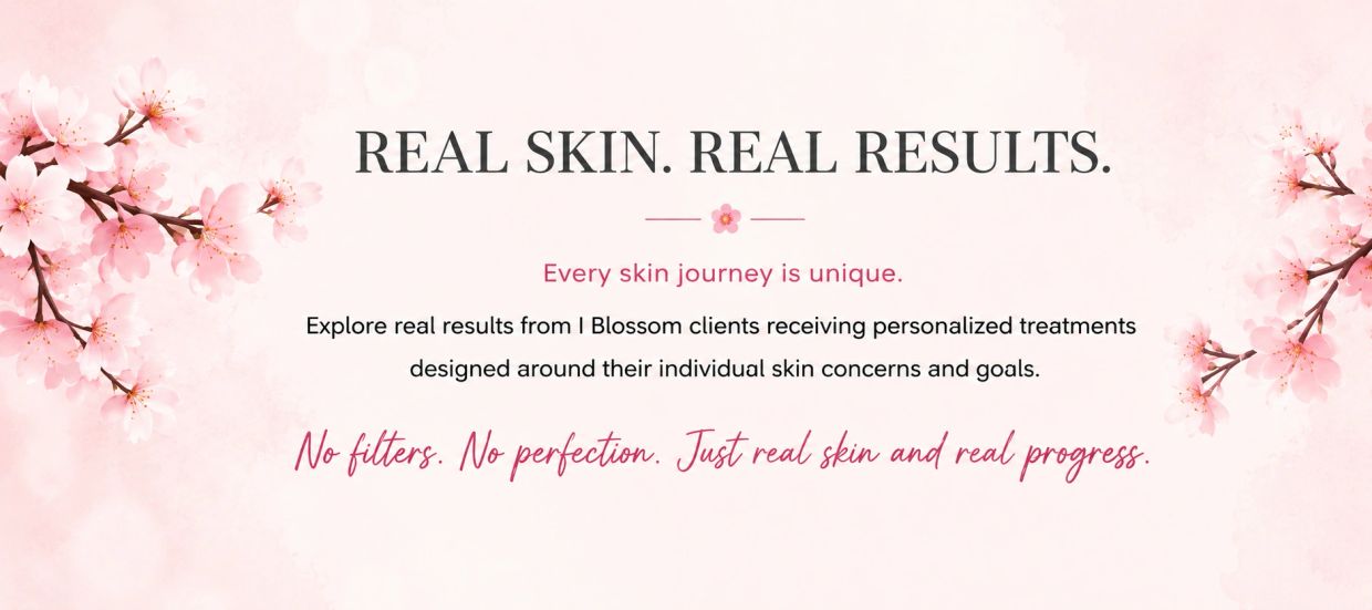 Real skin results with personalized treatments and no filters.