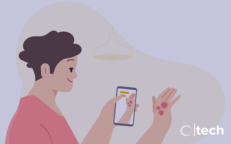 Google AI may help patients identify skin conditions Google AI may help patients identify skin conditions