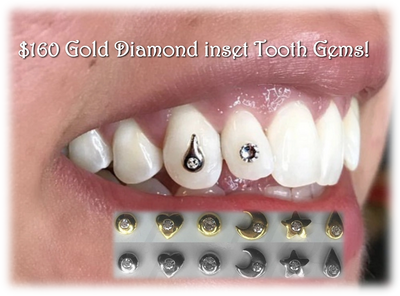 22k Gold Tooth Gems+Swarovski gem  Tooth gem, Diamond teeth, Gold teeth