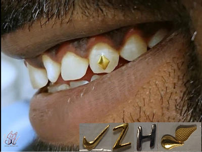 18k GOLD Tooth Gem