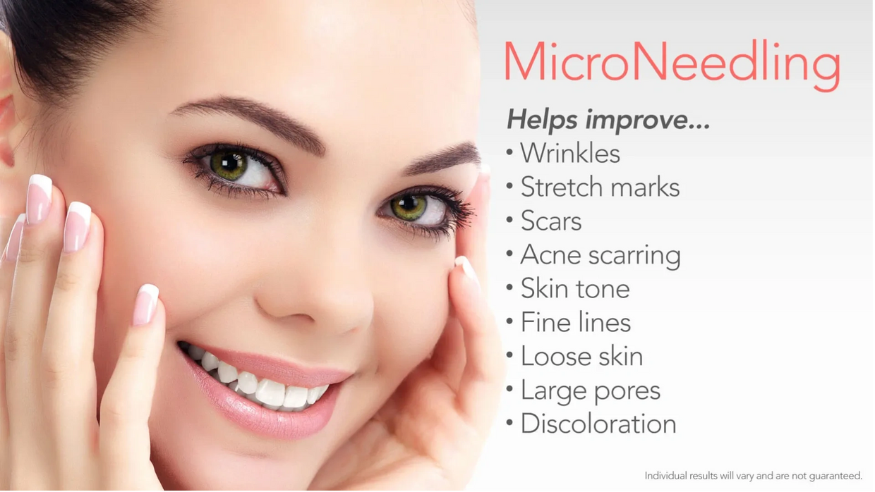 Now Offering MicroNeedling