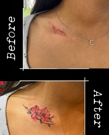 Transform Scars into Creative Tattoos