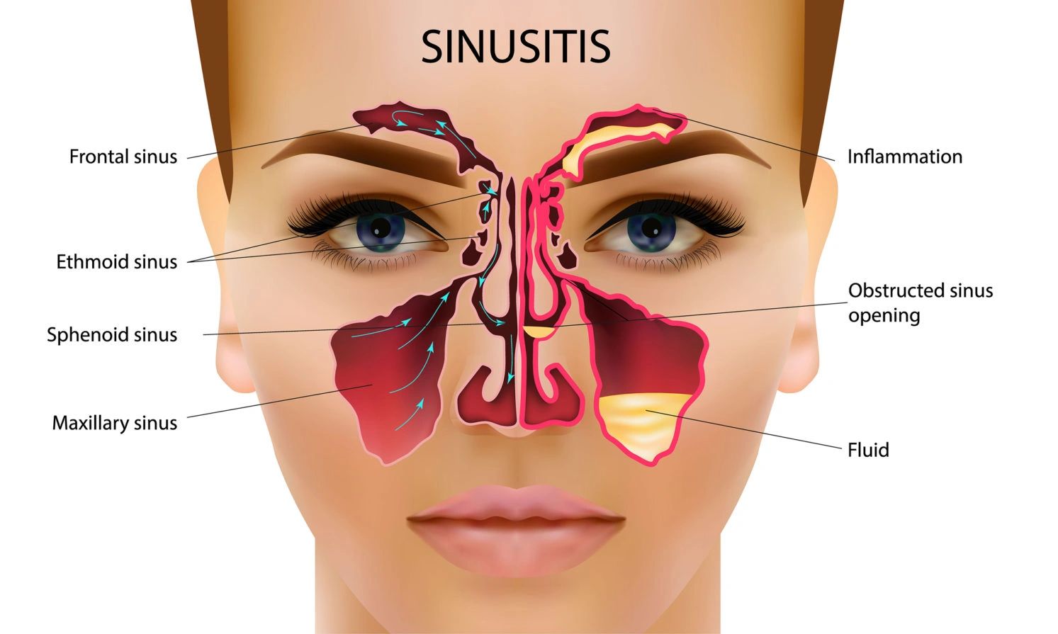 The BEST sinus rinse