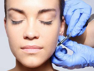 A photo of a manual exfoliation, where a scalpel blade is used to remove the dead skin and hair.