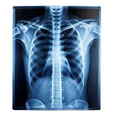 xray.webp