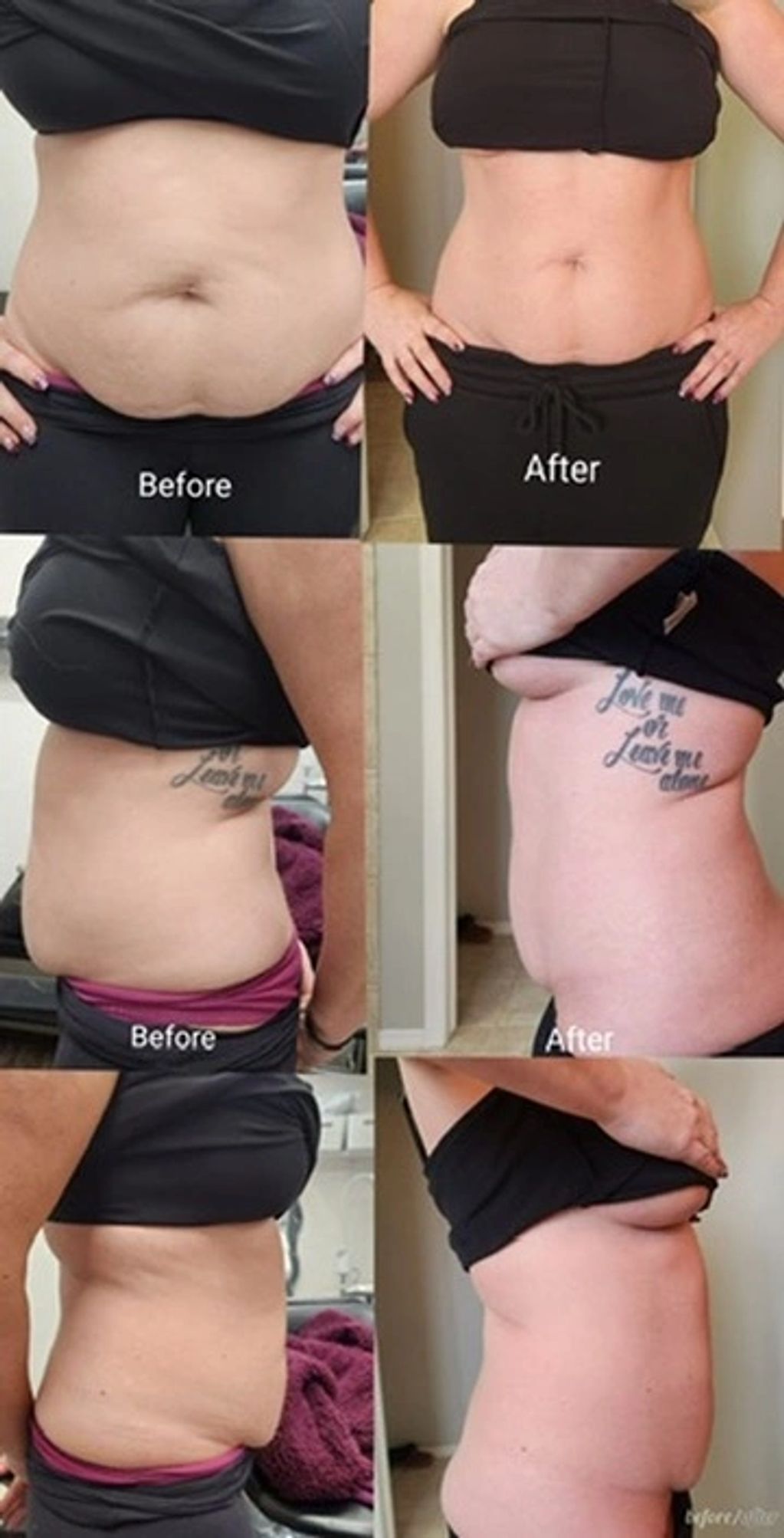 3 treatments administered three consecutive days in a row