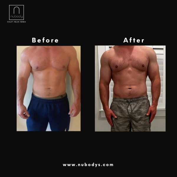glp-1 support diet Top GLP-1 Foods for Fat Loss: Your Guide