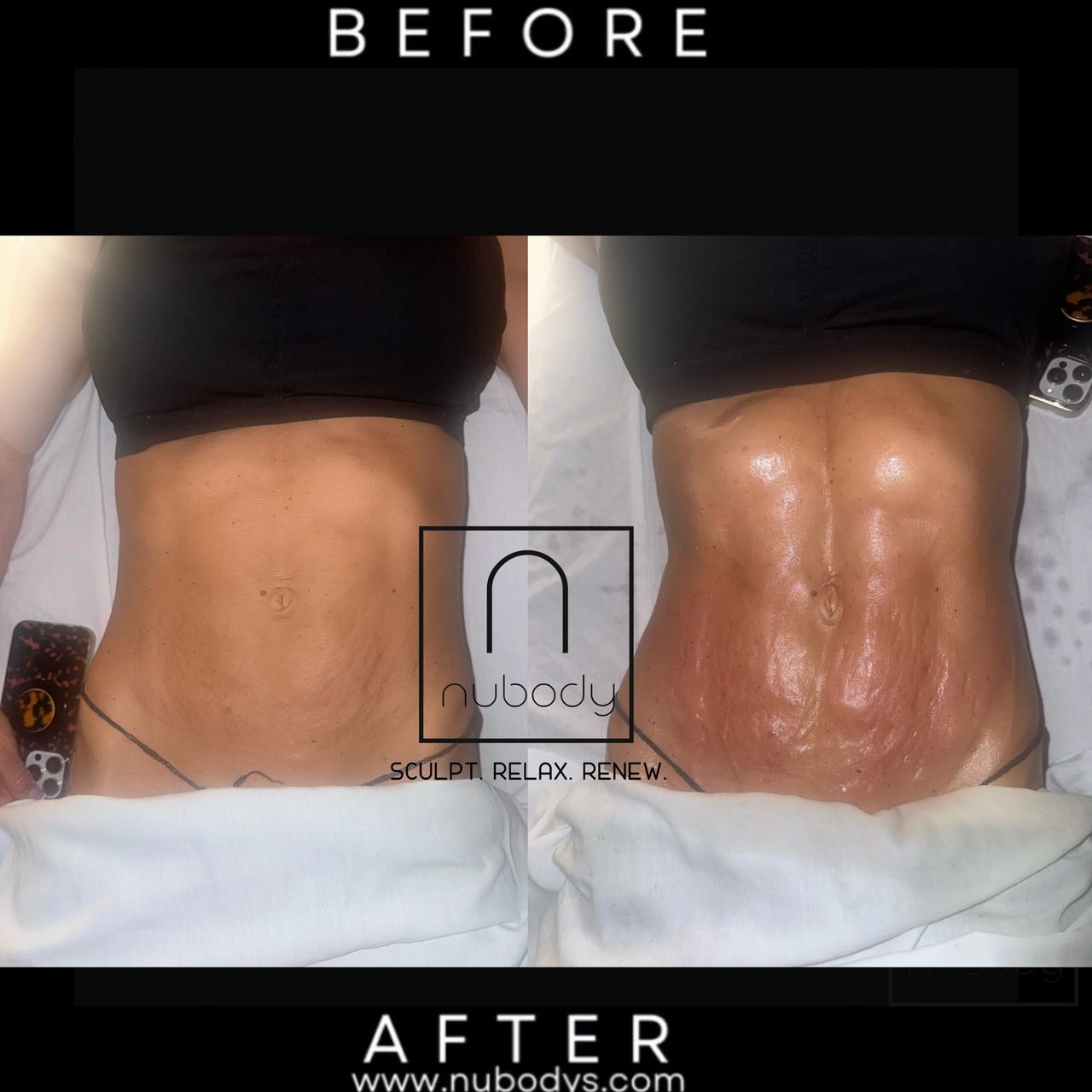 Why Our Signature Lymphatic Massage is a Must-Try!