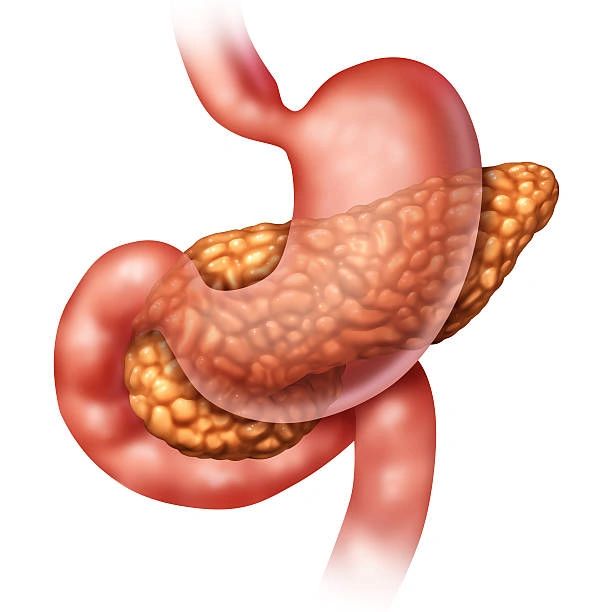 Causes of pancreatic cancer