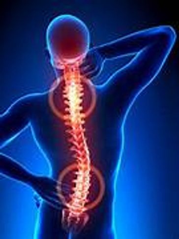 Hyperlordosis Hyperkyphosis scoliosis disc injury hypermobility diastasis recti tone pelvic floor 