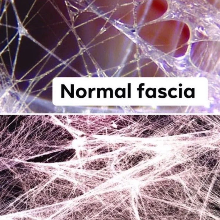 Myofascial Release Fascia after and before