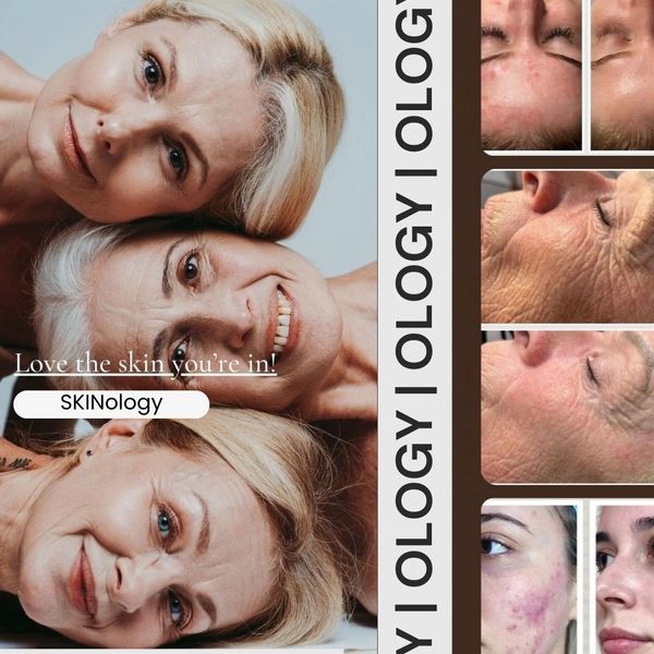 skinology, mature skin