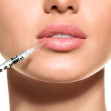 Dermal Lip Filler