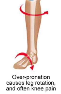 Anatomical image showing with arrows how pronation of the foot causes internal rotation at the knee.